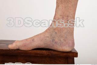 Photo reference of foot 0005